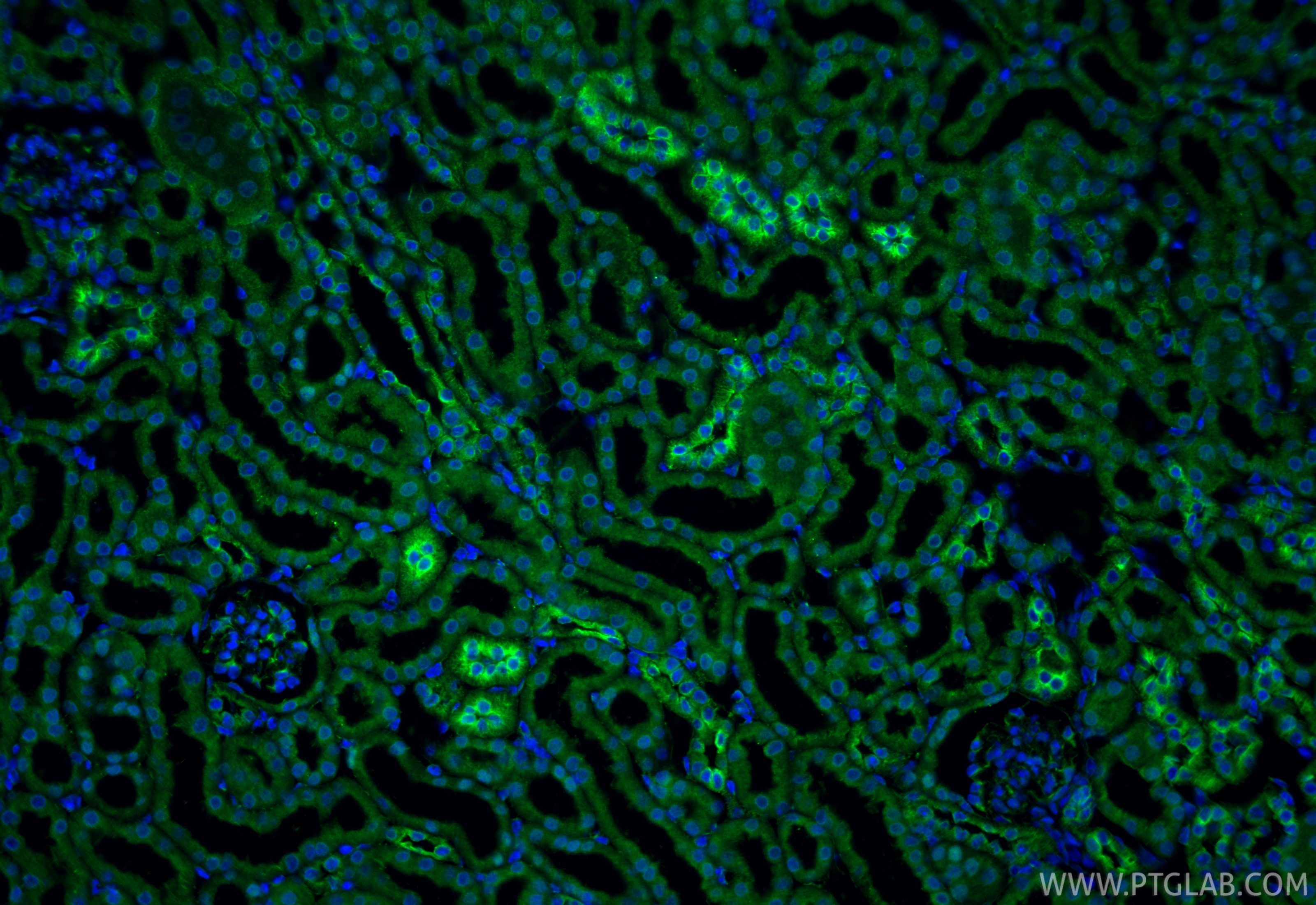 IF Staining of mouse kidney using 80017-1-RR (same clone as 80017-1-PBS)