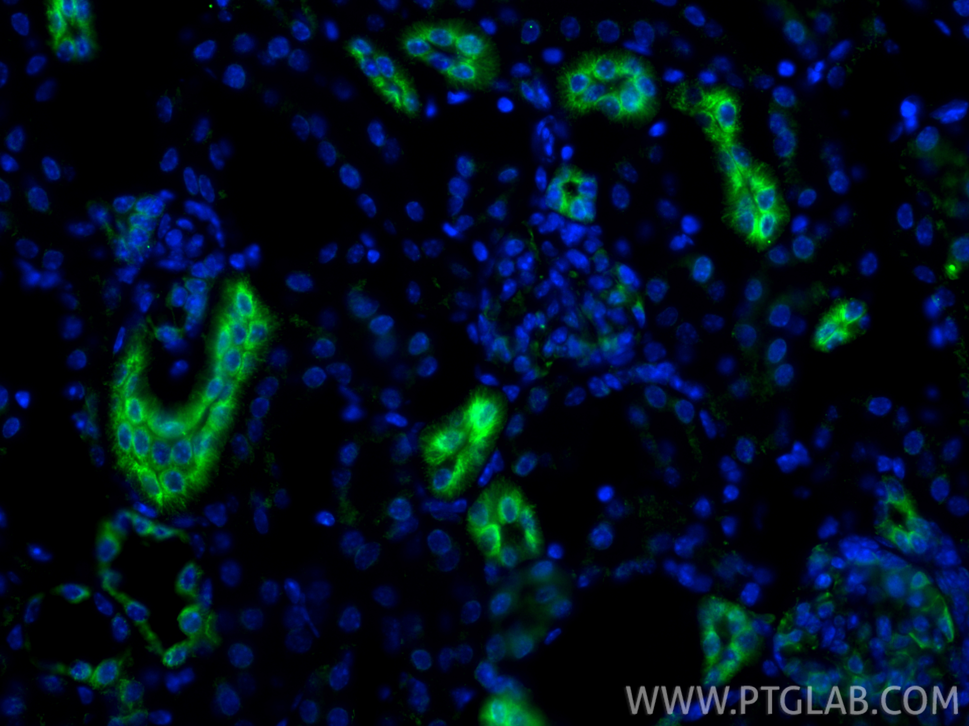 IF Staining of mouse kidney using 80017-1-RR IF Staining of mouse kidney using 80017-1-RR