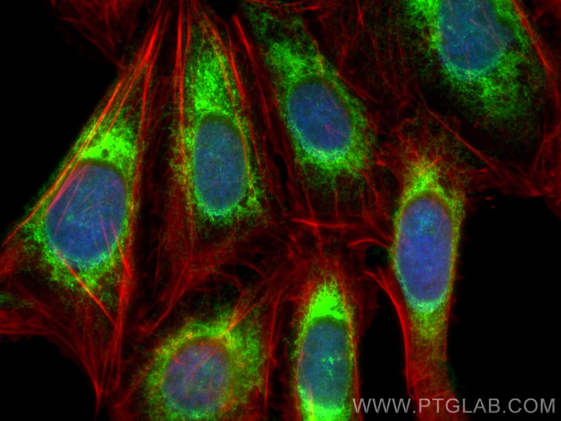 IF Staining of U2OS using 85593-6-RR (same clone as 85593-6-PBS)