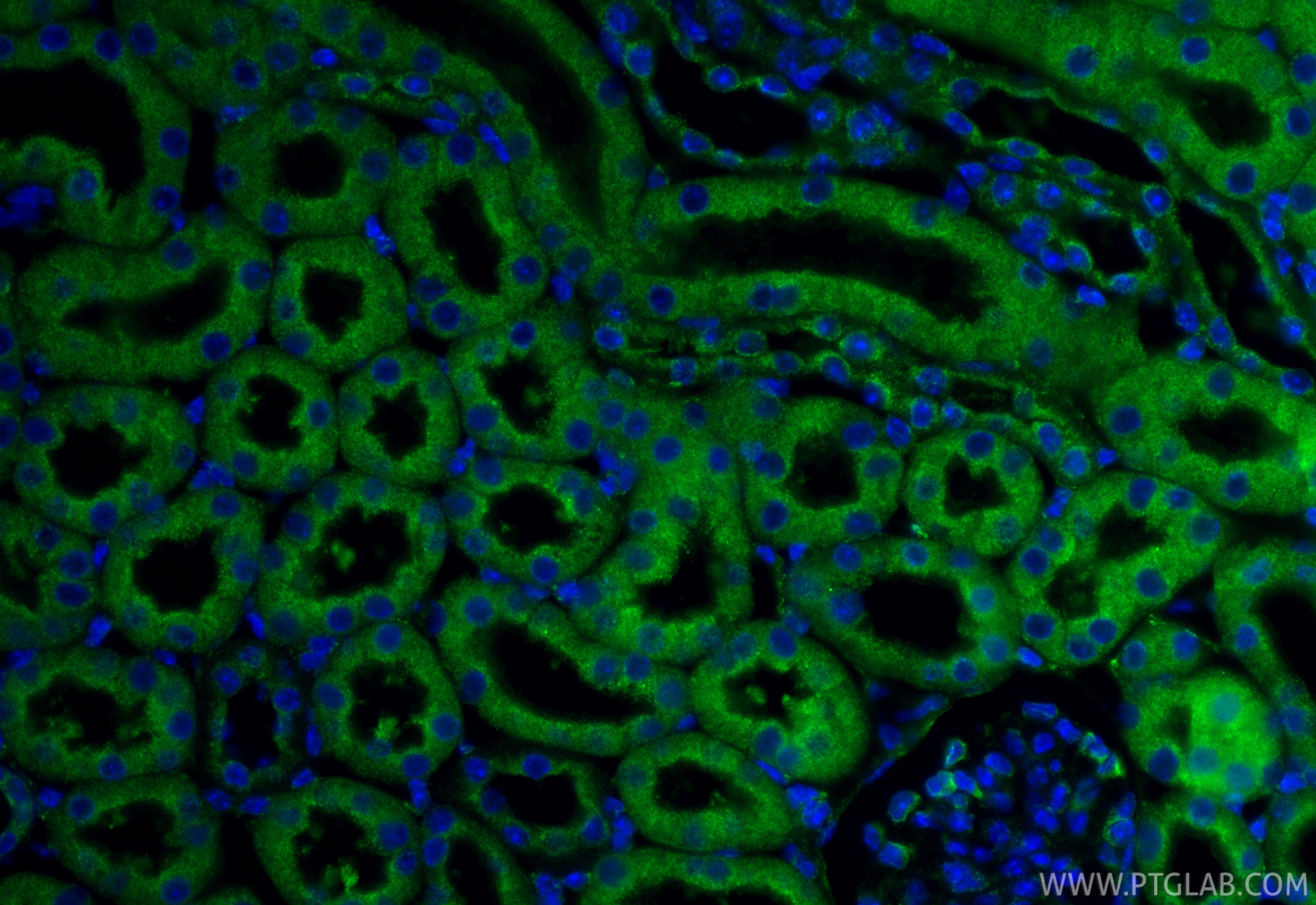 IF Staining of mouse kidney using 85593-6-RR