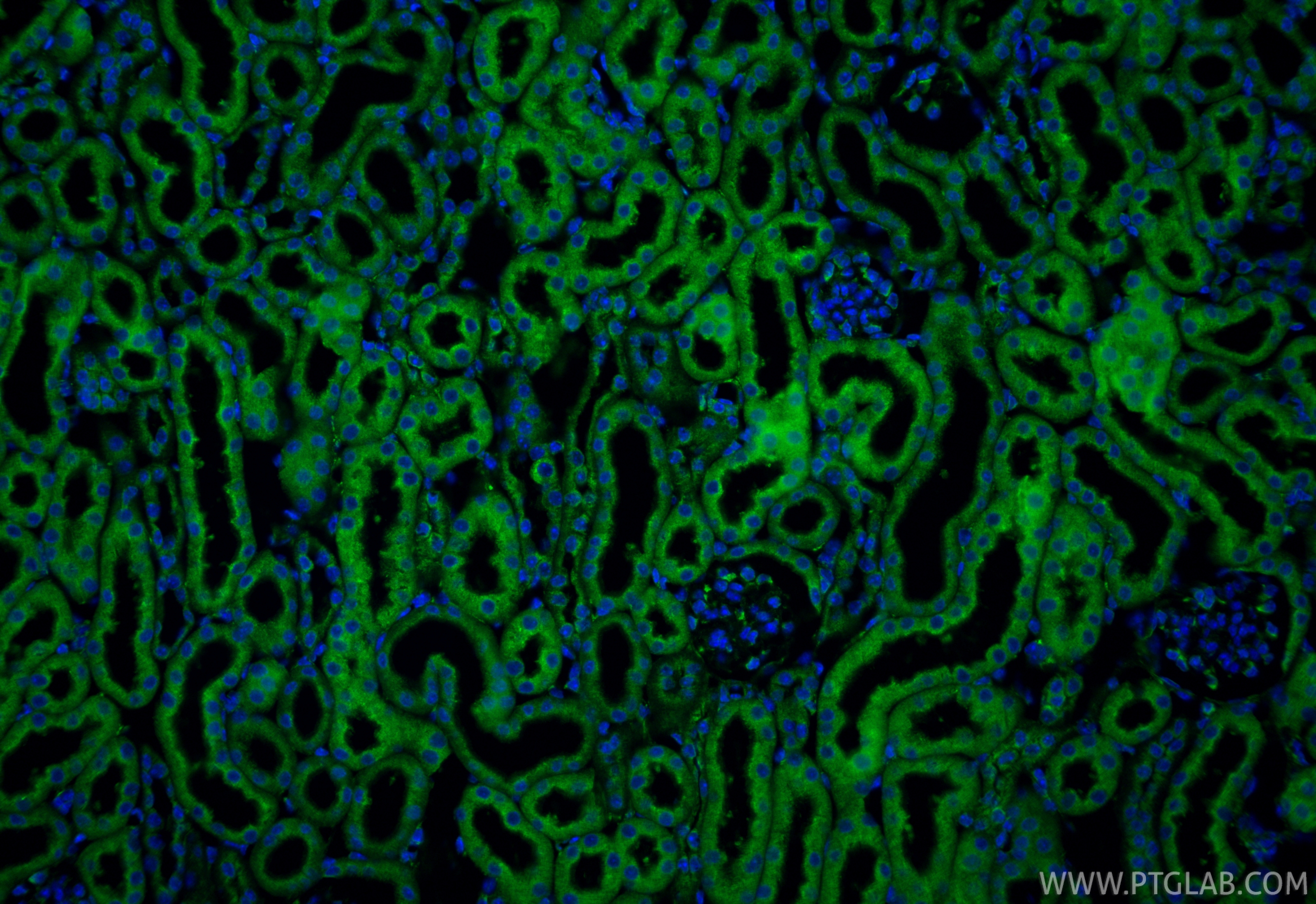 IF Staining of mouse kidney using 85593-6-RR