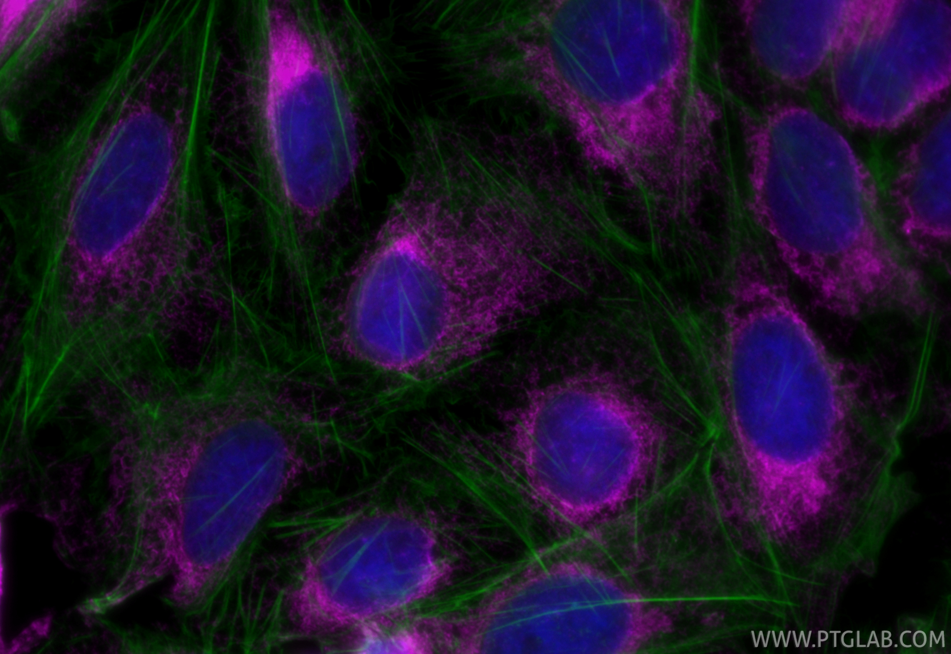 IF Staining of U2OS using APC-27298 IF Staining of U2OS using APC-27298