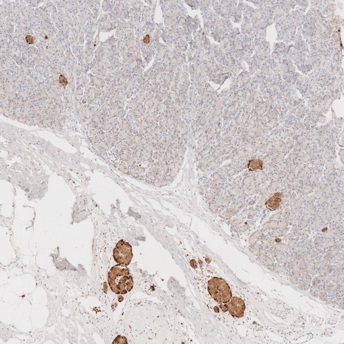 IHC staining of human pancreas using 60135-2-Ig IHC staining of human pancreas using 60135-2-Ig