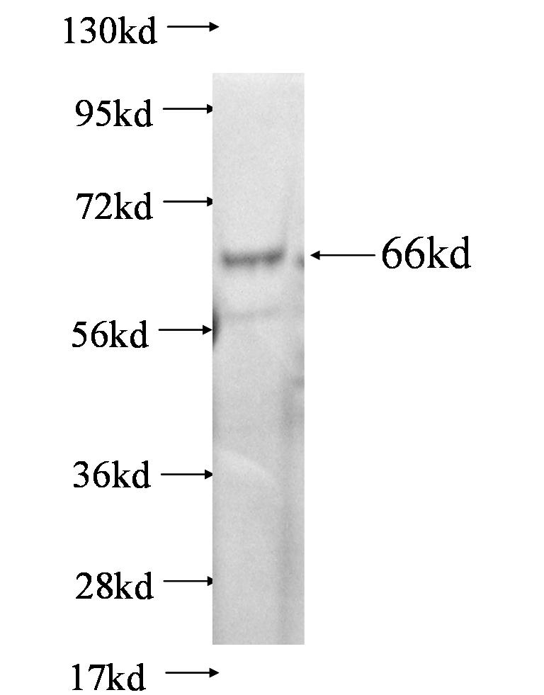 cka1 fusion protein Ag0722 SDS-PAGE cka1 fusion protein Ag0722 SDS-PAGE