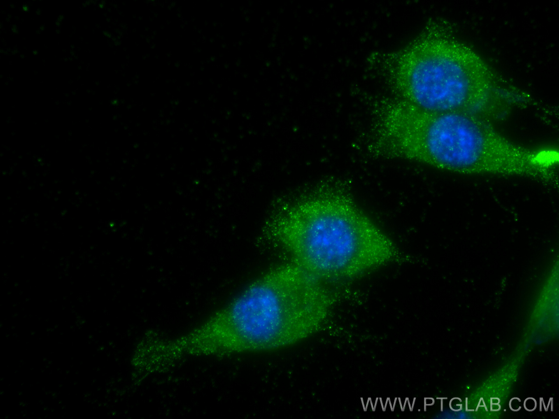 IF Staining of NIH/3T3 using 25128-1-AP