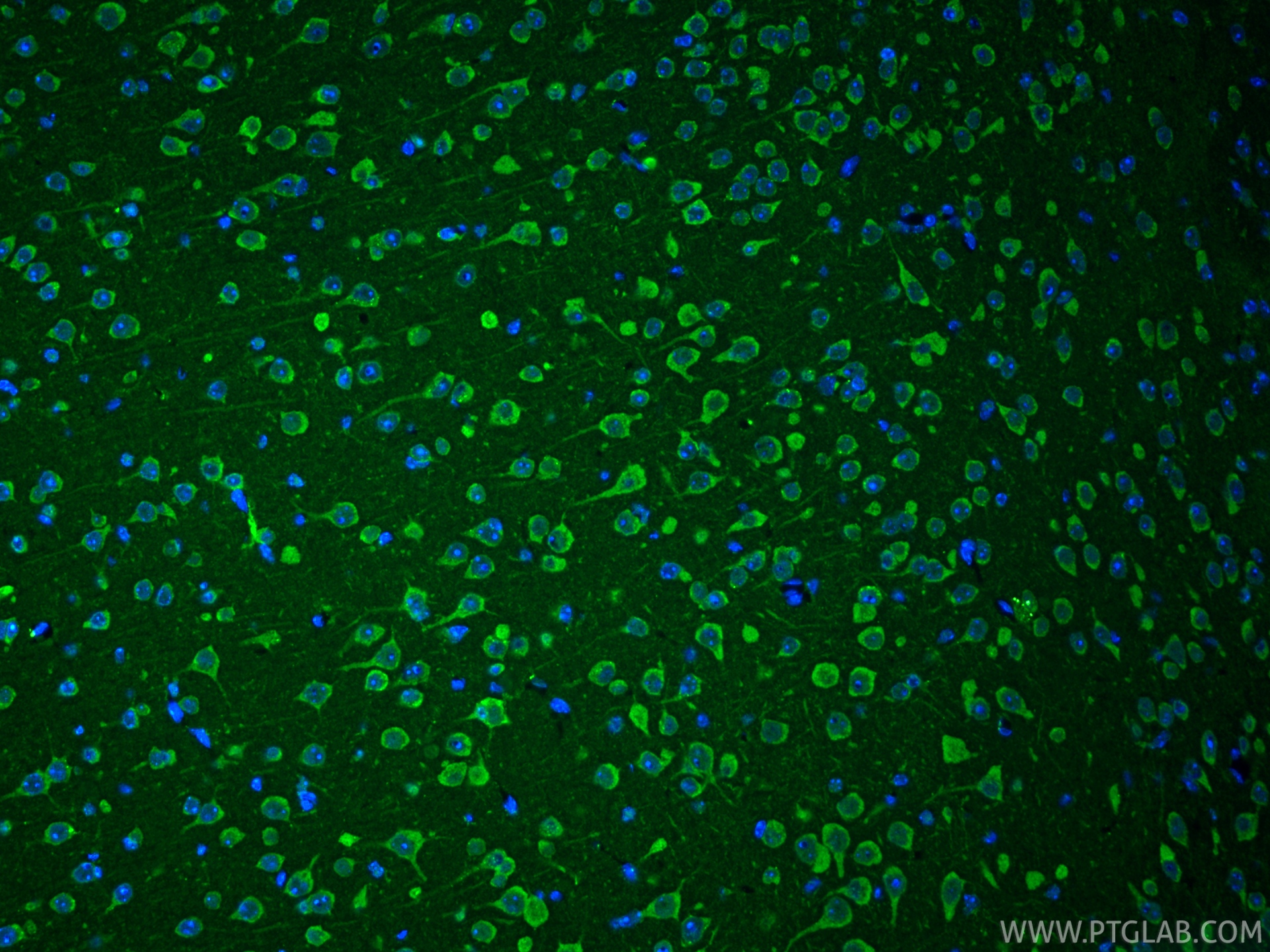 IF Staining of mouse brain using 25128-1-AP IF Staining of mouse brain using 25128-1-AP