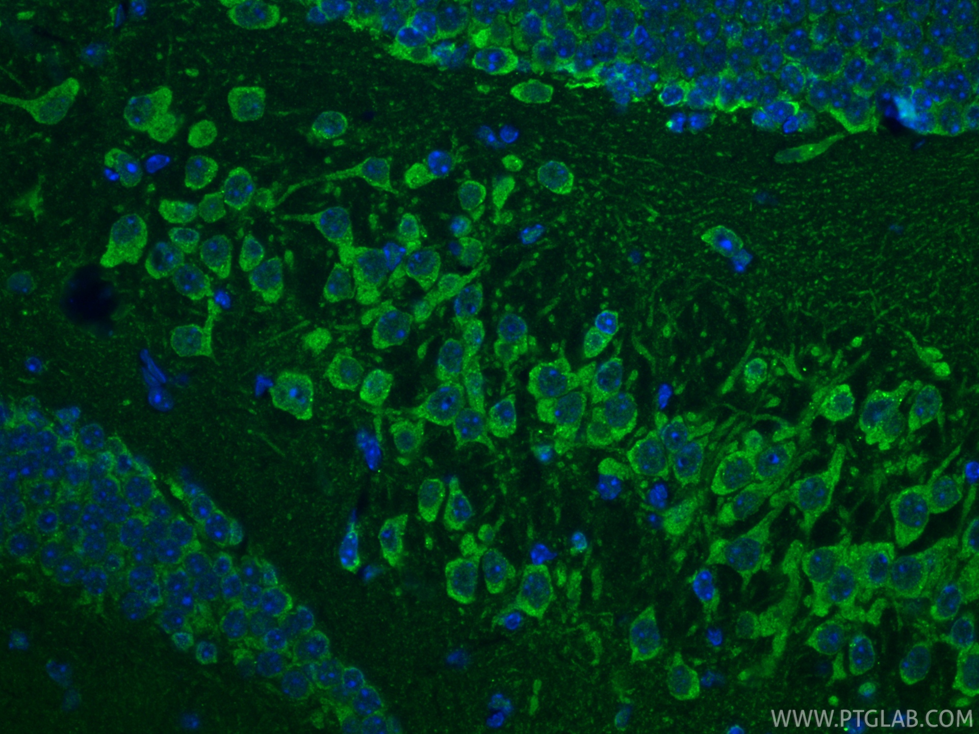 IF Staining of mouse brain using 25128-1-AP IF Staining of mouse brain using 25128-1-AP