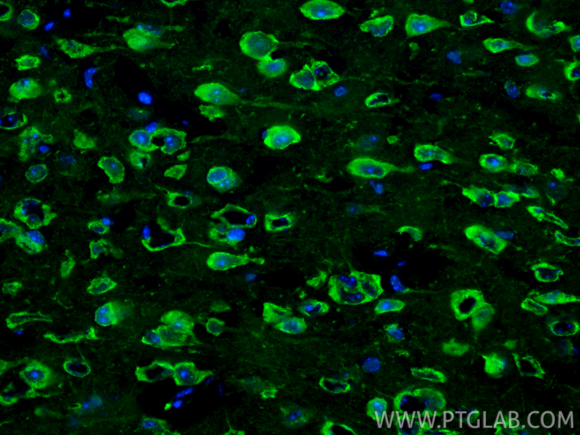 IF Staining of mouse brain using 25128-1-AP IF Staining of mouse brain using 25128-1-AP