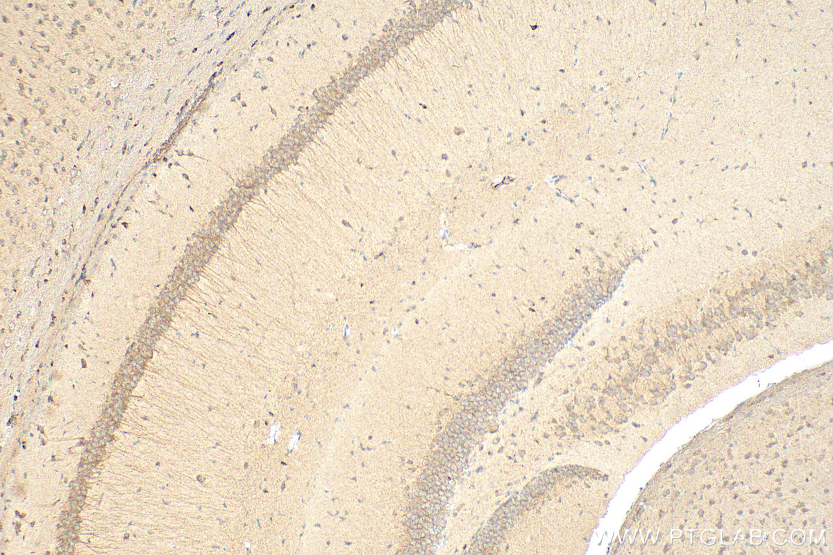 IHC staining of mouse brain using 25128-1-AP