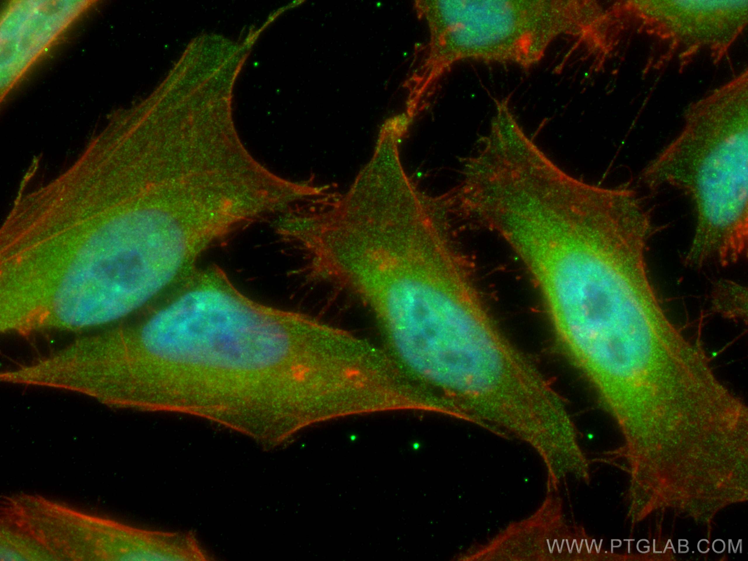 IF Staining of HeLa using 67686-1-Ig