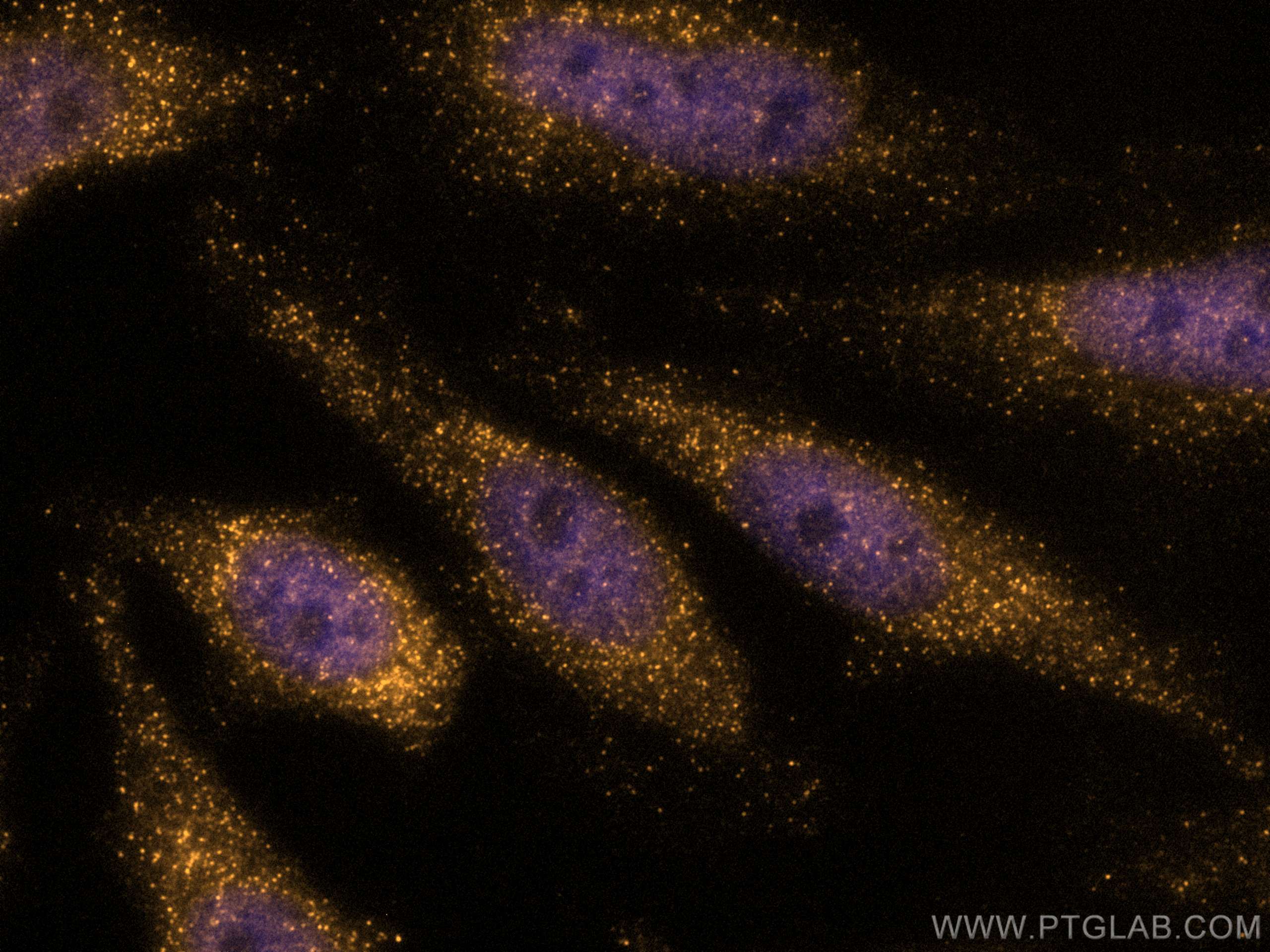 IF Staining of HeLa using CL555-67686