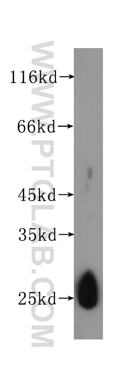 WB analysis of Recombinant protein using 60158-1-Ig