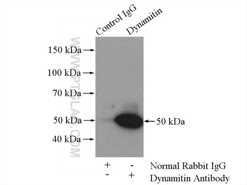 IP experiment of mouse brain using 10030-2-AP