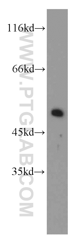 WB analysis of mouse brain using 10030-2-AP