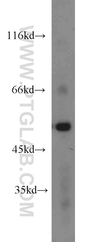 WB analysis of mouse lung using 10032-1-AP