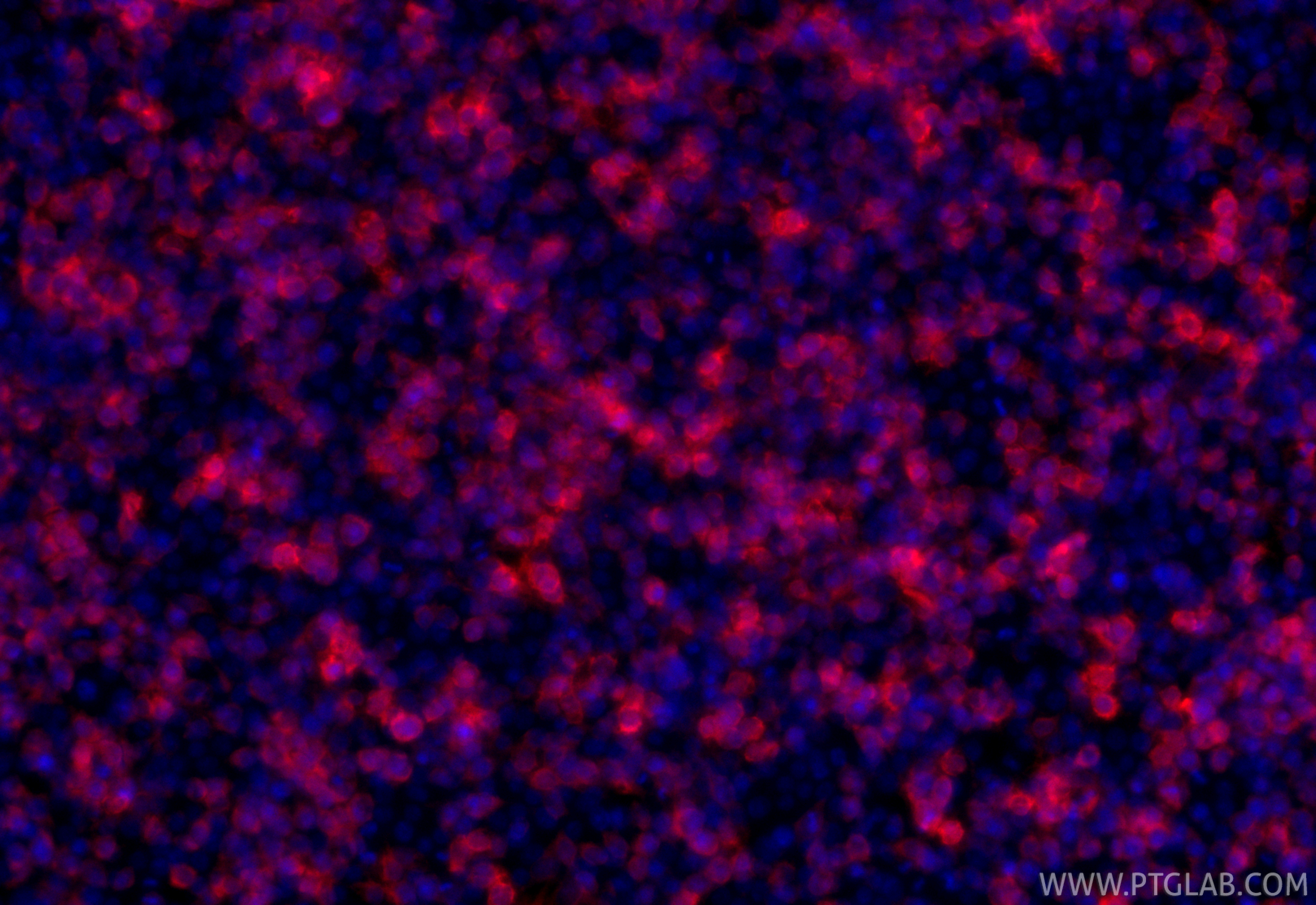 IF Staining of Transfected HEK-293 using 50430-2-AP IF Staining of Transfected HEK-293 using 50430-2-AP