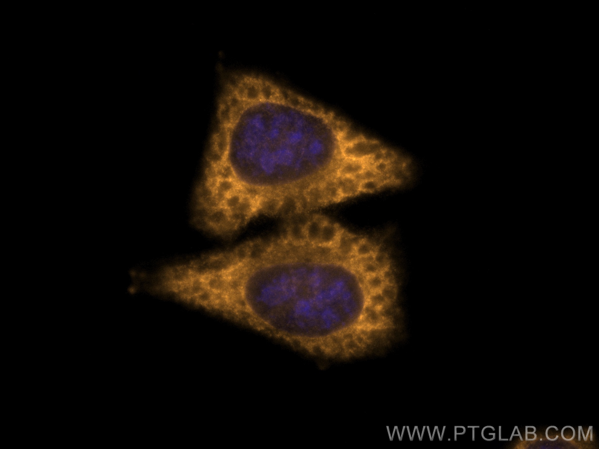 IF Staining of HepG2 using CL555-67428