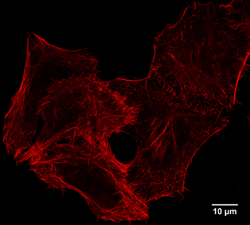 Confocal images of HeLa cells expressing Tom70-EGFP-Spot-Tag immunostained with Spot-Label ATTO594 bivalent (1:1,000). Left: EGFP fluorescence, middle: ATTO594 signal, right: merge. Scale bar, 10 μm. The images were acquired with Leica TCS SP8 microscope, 100X oil objective, at the Core Facility Bioimaging at the Biomedical Center, LMU Munich, and deconvolved with Huygens Professional (SVI). Left: GFP fluorescence, middle: ATTO594 signal, right: merge. Scale bar, 10 μm.