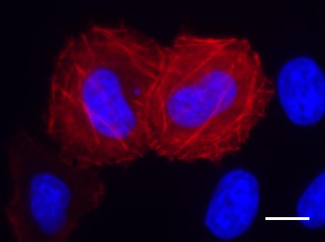 HeLa cells were transfected with the Spot-Tag®-Actin plasmid overnight, fixed, stained with Spot-Label ATTO594 (product code eba594), and imaged using 40X objective. Spot-Tag®-Actin filaments in red, cell nuclei in blue (DAPI). Scale bar 10 µm.