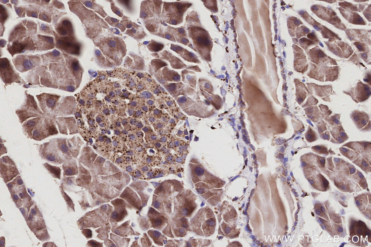 IHC staining of mouse pancreas using 67002-1-Ig IHC staining of mouse pancreas using 67002-1-Ig