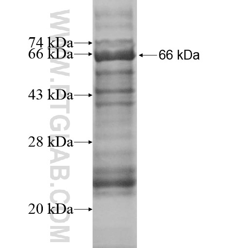 fetuin-B fusion protein Ag12562 SDS-PAGE