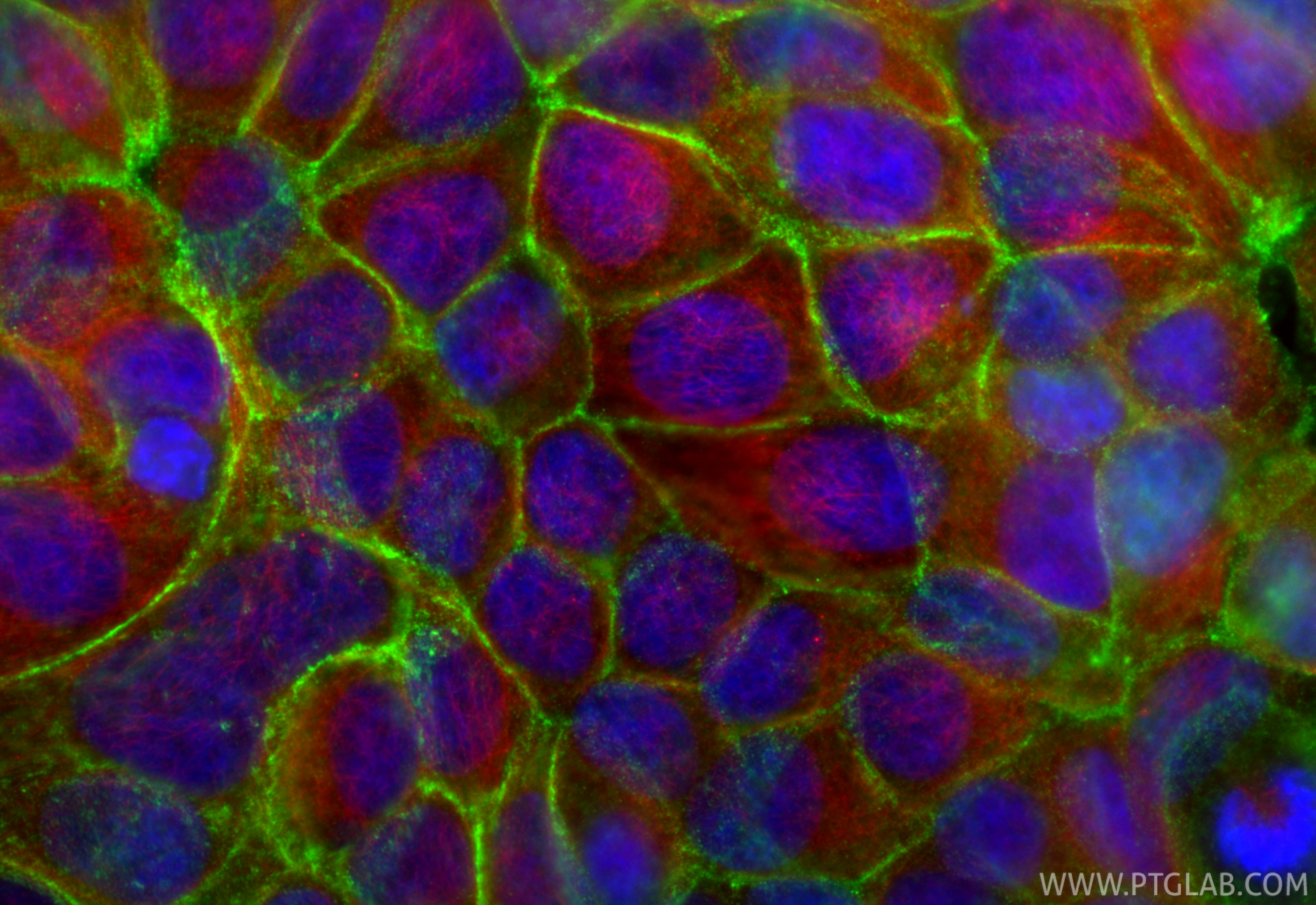 IF Staining of MCF-7 using 27872-1-AP