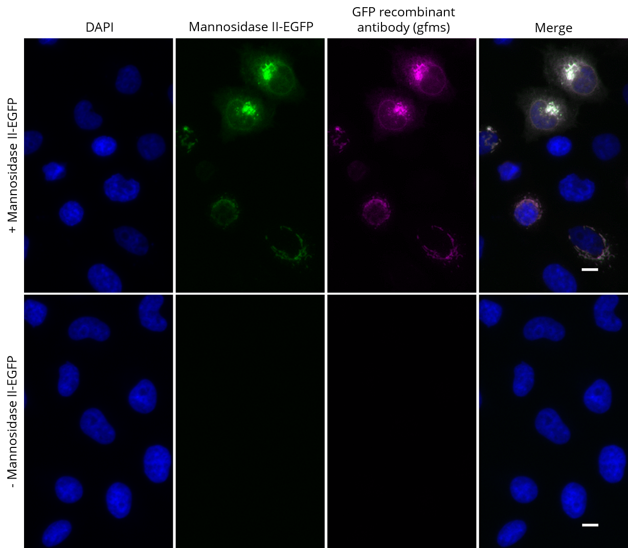 HeLa cells transiently expressing Mannosidase II-EGFP were immunostained with GFP recombinant antibody, VHH-mouse IgG1 Fc fusion [CTK0201] (gfms, 1:2,000) and Nano-Secondary® alpaca anti-mouse IgG1, recombinant VHH, Alexa Fluor® 647 [CTK0103, CTK0104] (sms1AF647-1, 1:500). Scale bar, 10 μM.