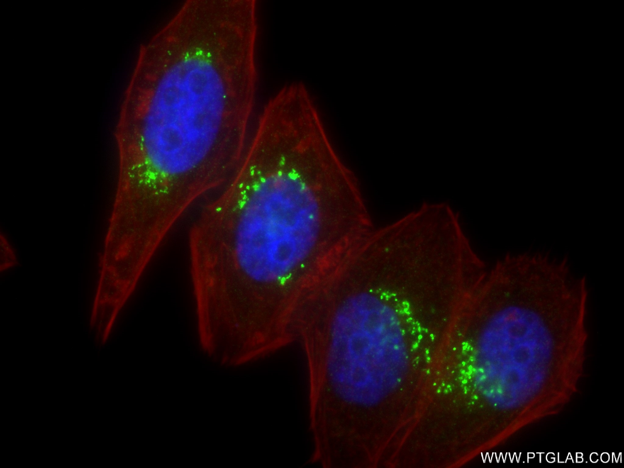IF Staining of HepG2 using 83009-4-RR