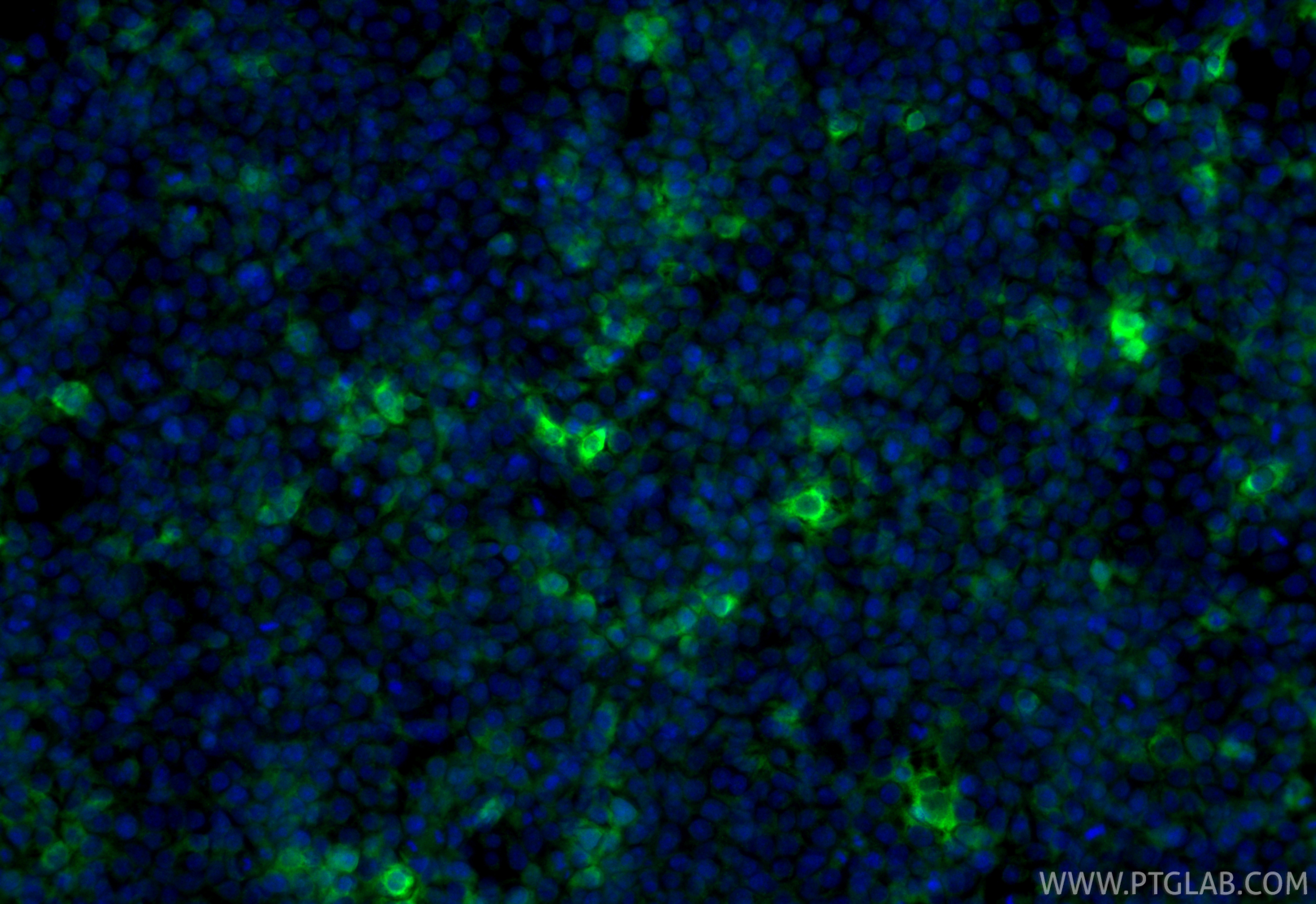 IF Staining of Transfected HEK-293 using 10000-0-AP