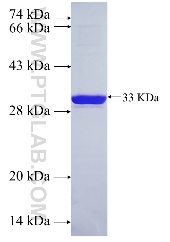 hCG_17324 fusion protein Ag38876 SDS-PAGE hCG_17324 fusion protein Ag38876 SDS-PAGE