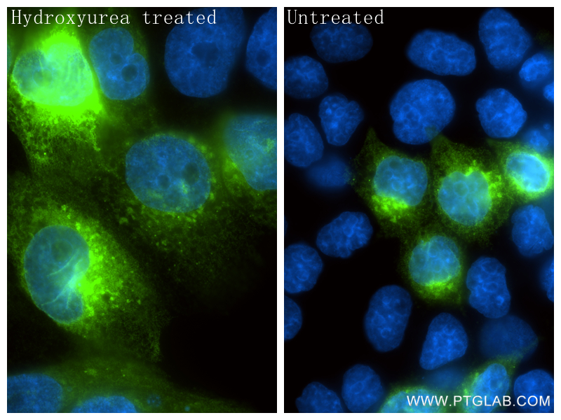 Immunofluorescent analysis of (4% PFA) fixed Hydroxyurea treated JAR cells using hCG Alpha antibody (<a class='green' href='/productredirect?CatalogNo=85800-9-RR' target='_blank'>85800-9-RR</a>, Clone: 250136C4 ) at dilution of 1:800 and CoraLite®488-Conjugated Goat Anti-Rabbit IgG(H+L) (<a class='green' href='/productredirect?CatalogNo=SA00013-2' target='_blank'>SA00013-2</a>). This data was developed using the same antibody clone with 85800-9-PBS in a different storage buffer formulation. IF Staining of JAR using 85800-9-RR (same clone as 85800-9-PBS)