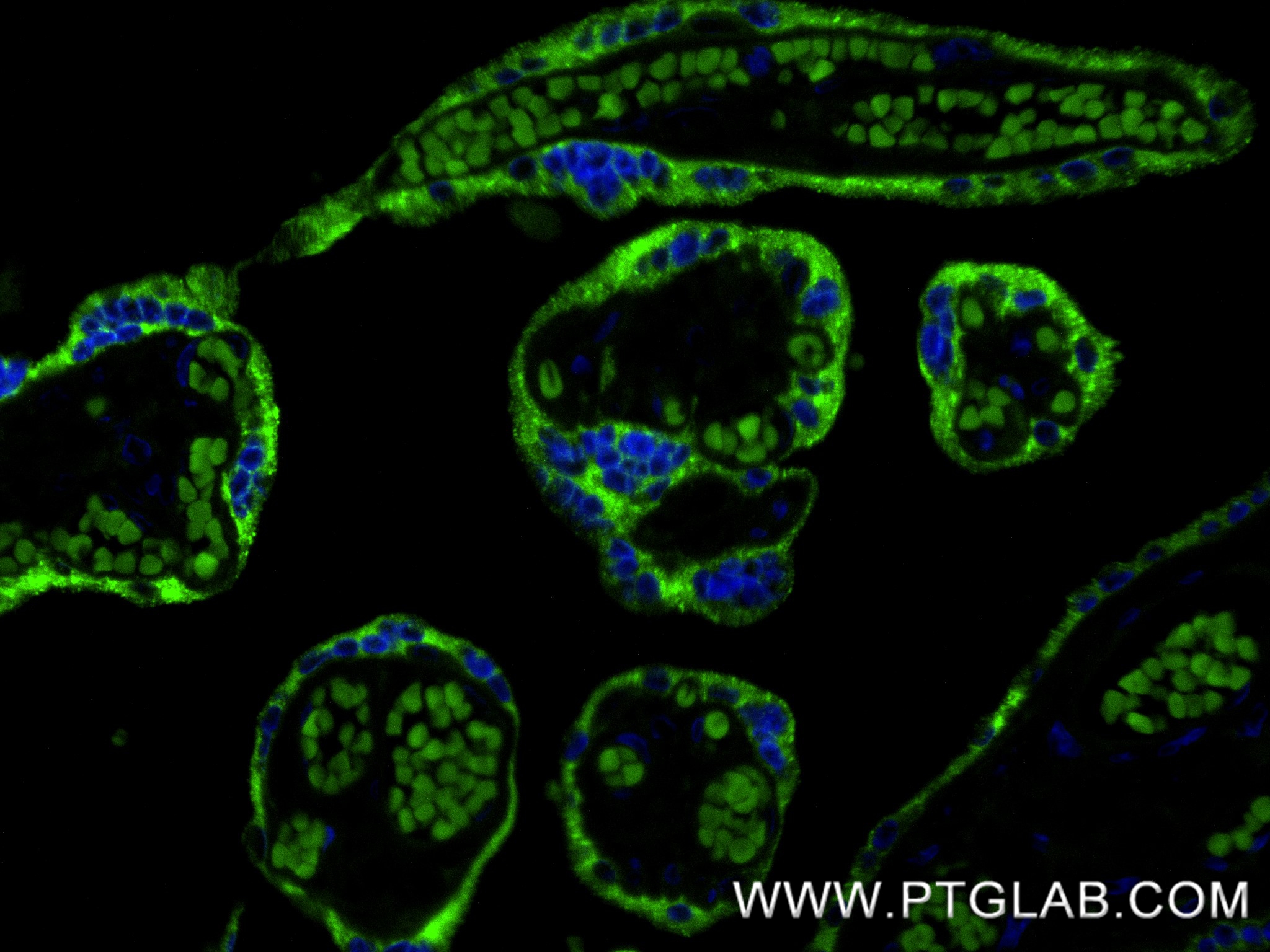 IF Staining of human placenta using 85800-9-RR (same clone as 85800-9-PBS) IF Staining of human placenta using 85800-9-RR (same clone as 85800-9-PBS)