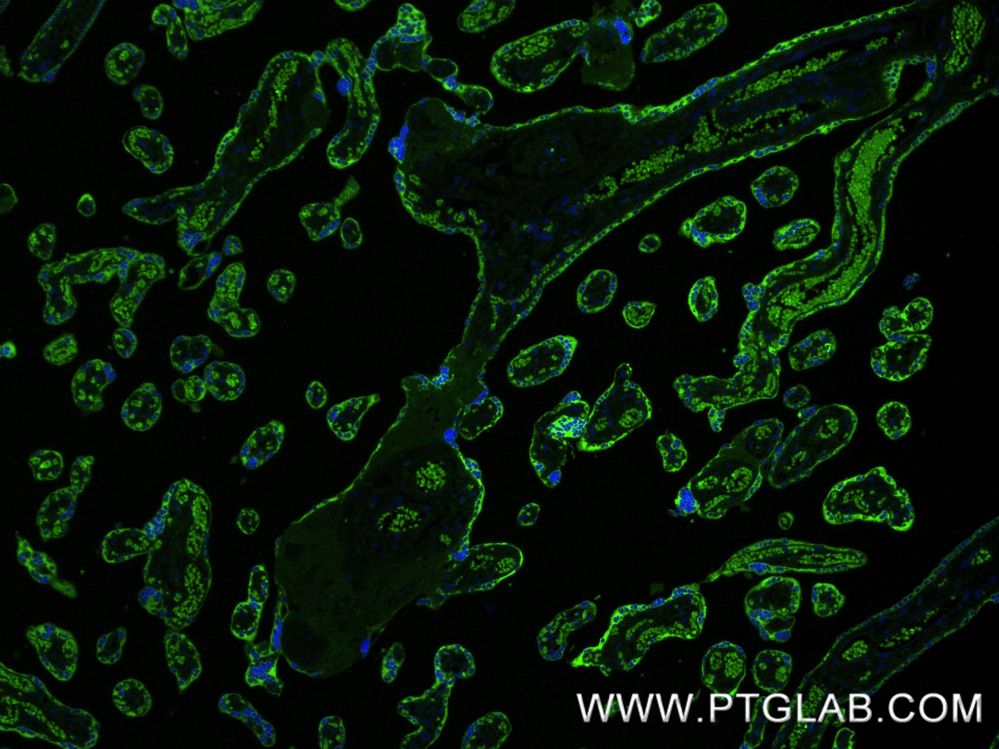 IF Staining of human placenta using 85800-9-RR (same clone as 85800-9-PBS) IF Staining of human placenta using 85800-9-RR (same clone as 85800-9-PBS)