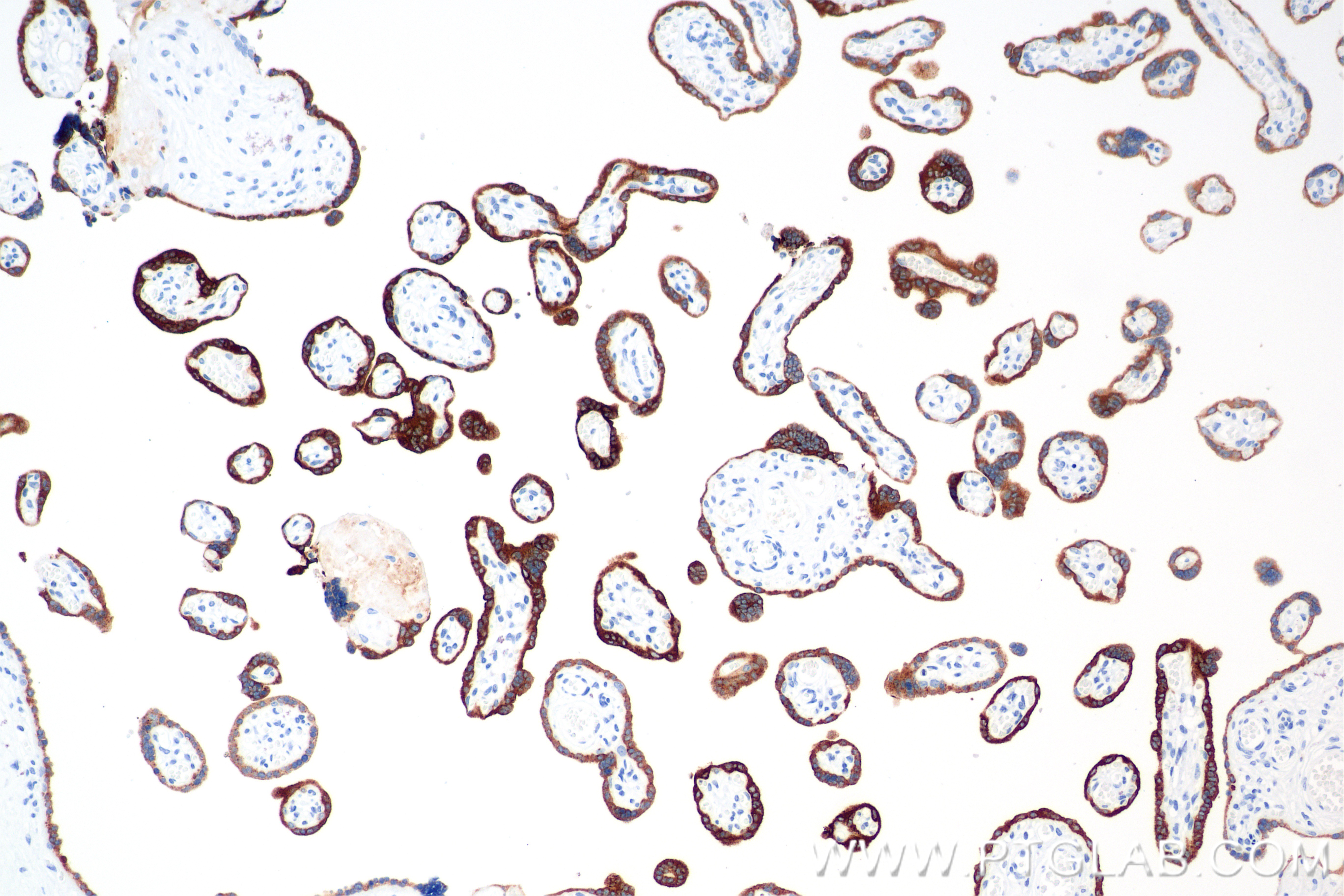 Immunohistochemical analysis of paraffin-embedded human placenta tissue slide using <a class='green' href='/productredirect?CatalogNo=85800-9-RR' target='_blank'>85800-9-RR</a> (CGA antibody) at dilution of 1:1000 (under 10x lens). Heat mediated antigen retrieval with Tris-EDTA buffer (pH 9.0). This data was developed using the same antibody clone with 85800-9-PBS in a different storage buffer formulation. IHC staining of human placenta using 85800-9-RR (same clone as 85800-9-PBS)