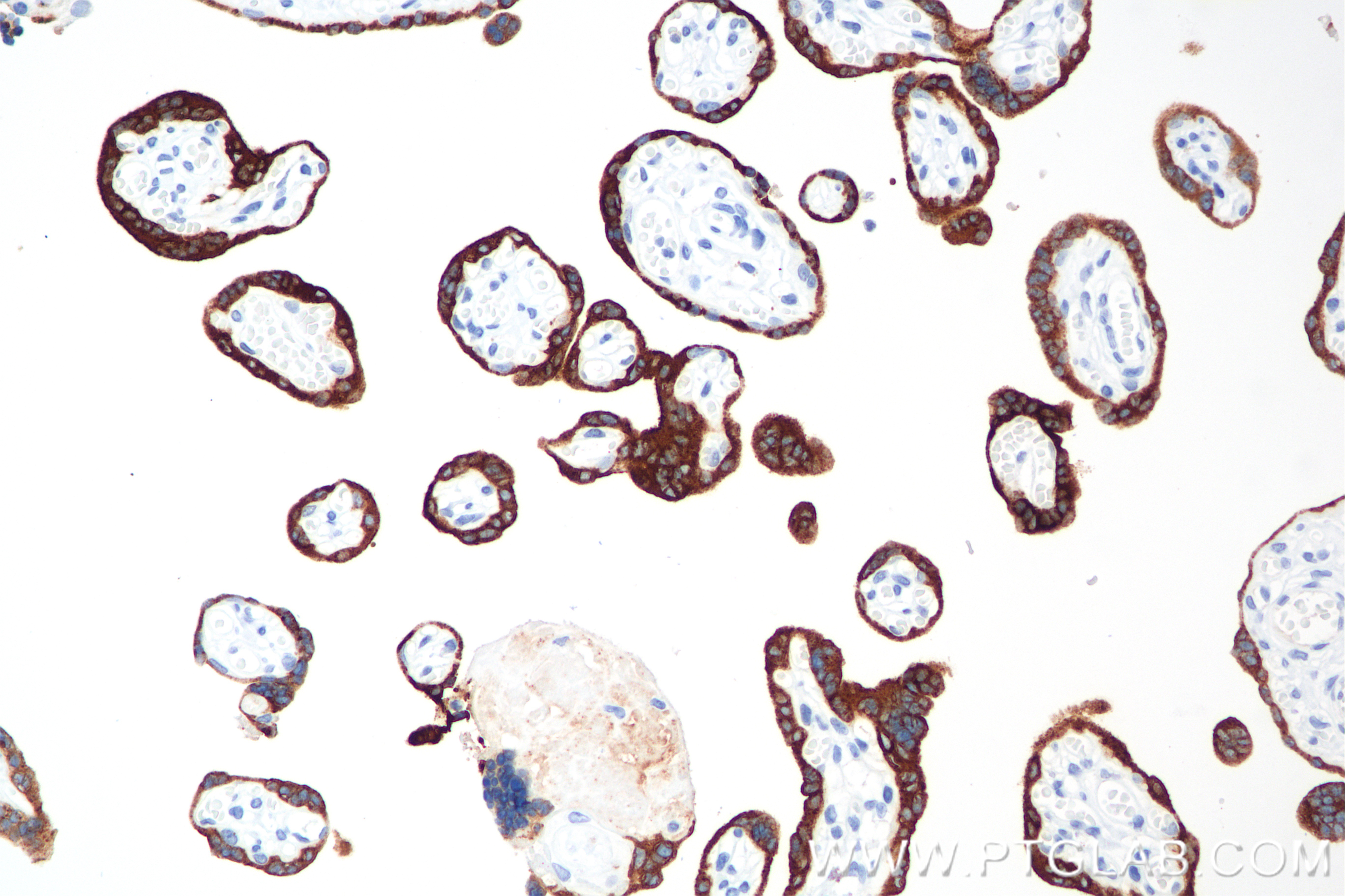 Immunohistochemical analysis of paraffin-embedded human placenta tissue slide using <a class='green' href='/productredirect?CatalogNo=85800-9-RR' target='_blank'>85800-9-RR</a> (CGA antibody) at dilution of 1:1000 (under 20x lens). Heat mediated antigen retrieval with Tris-EDTA buffer (pH 9.0). This data was developed using the same antibody clone with 85800-9-PBS in a different storage buffer formulation. IHC staining of human placenta using 85800-9-RR (same clone as 85800-9-PBS)