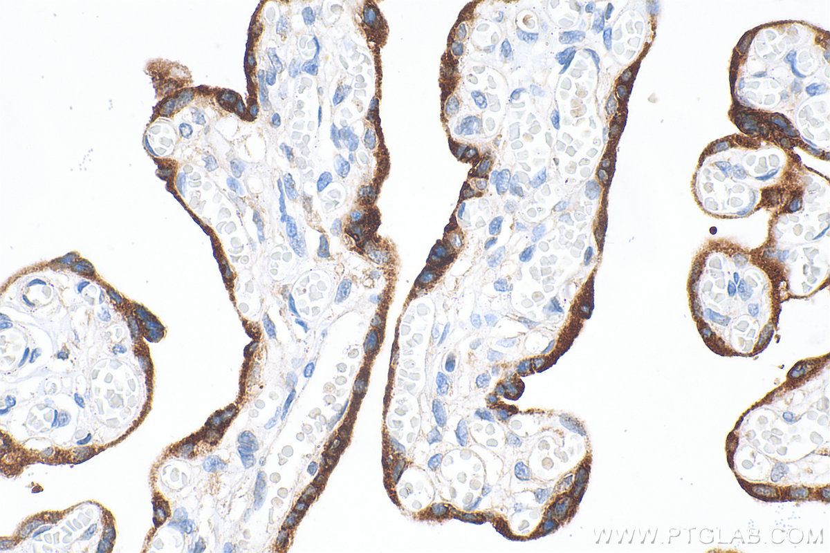 IHC staining of human placenta using 33278-1-AP (same clone as 33278-1-PBS)