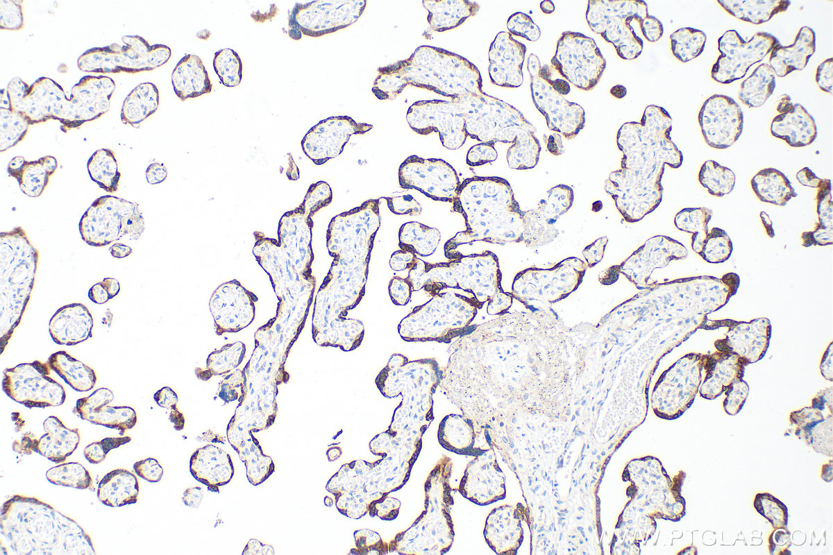 IHC staining of human placenta using 33278-1-AP (same clone as 33278-1-PBS)