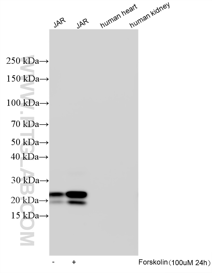 WB analysis using 33278-1-AP (same clone as 33278-1-PBS)