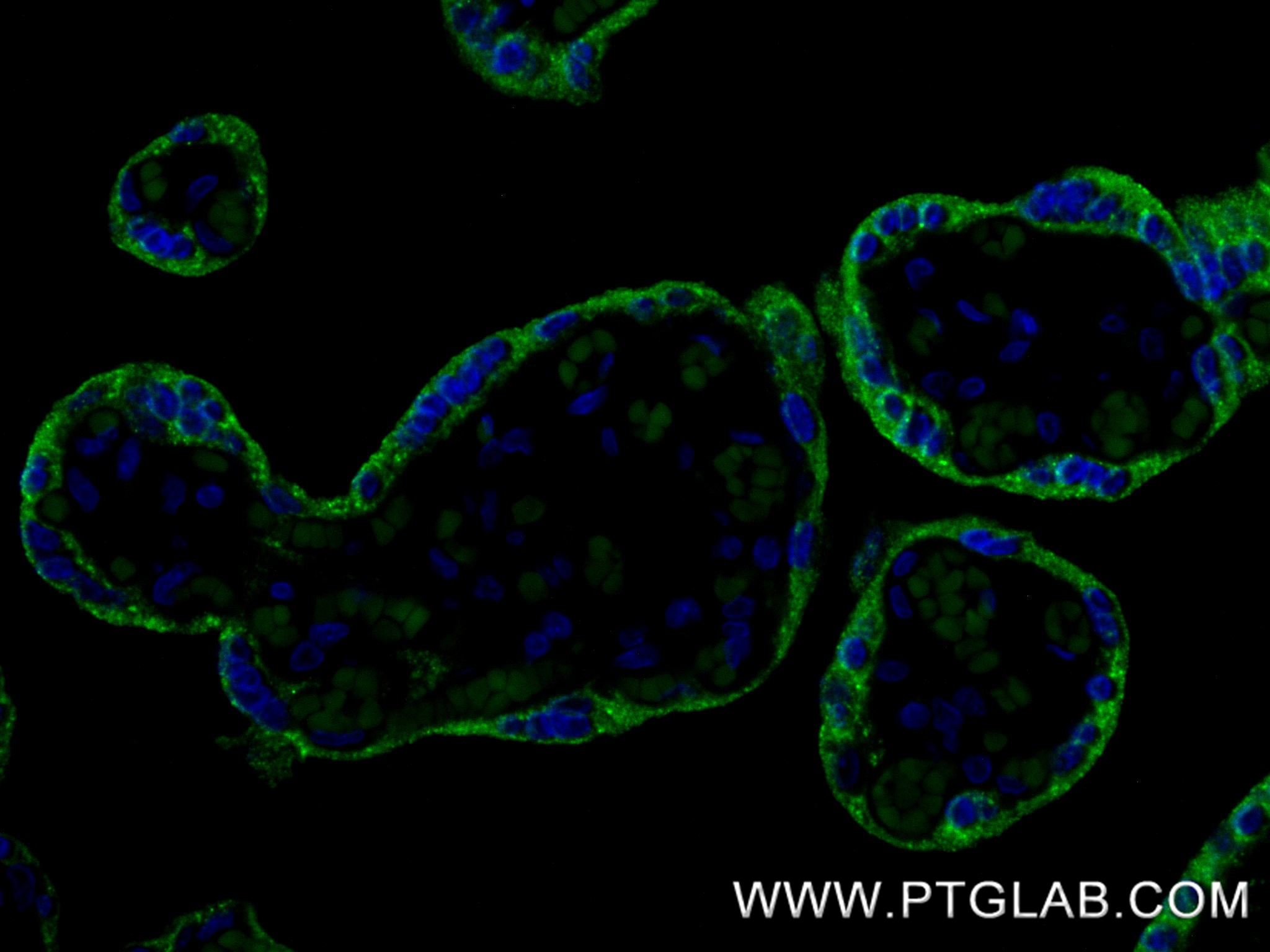 IF Staining of human placenta using 85800-7-RR