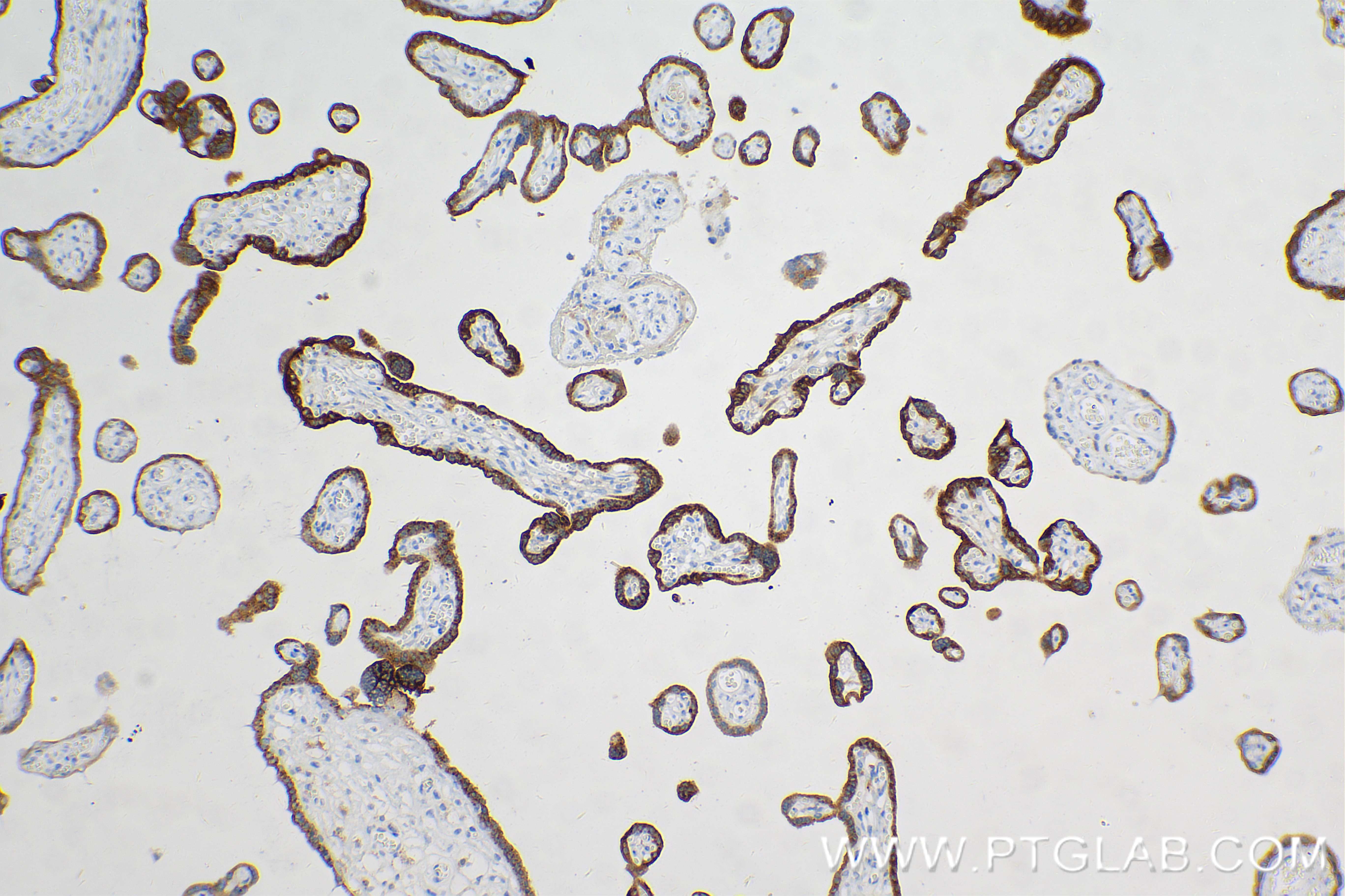IHC staining of human placenta using 85800-7-RR (same clone as 85800-7-PBS)