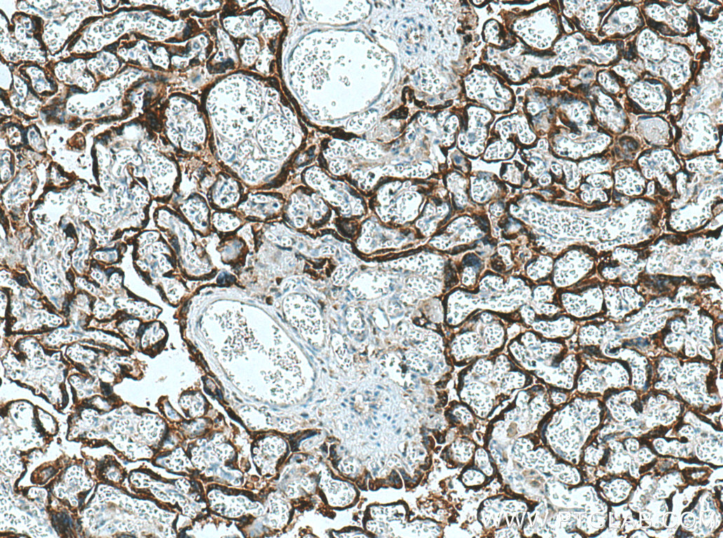 IHC staining of human placenta using 25014-1-AP (same clone as 25014-1-PBS)