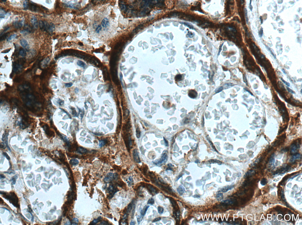 IHC staining of human placenta using 25014-1-AP (same clone as 25014-1-PBS)