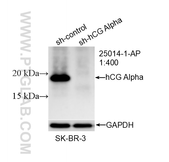 WB analysis of SK-BR-3 using 25014-1-AP WB analysis of SK-BR-3 using 25014-1-AP