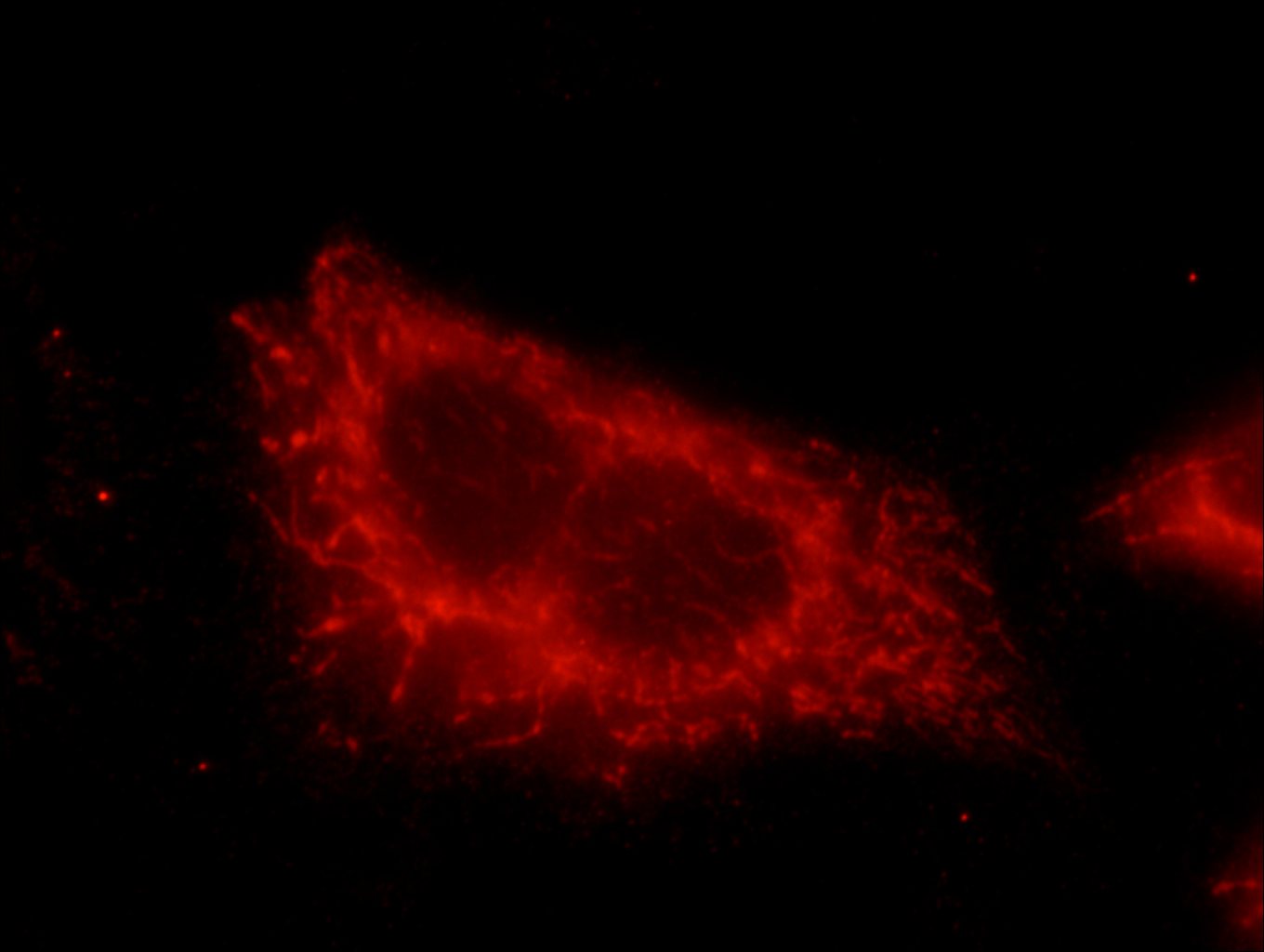 IF Staining of HeLa using 20988-1-AP