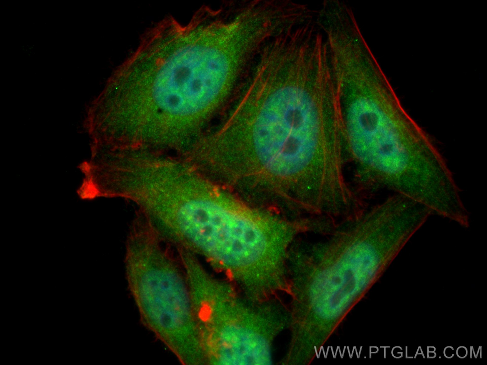 IF Staining of HepG2 using 14523-1-AP (same clone as 14523-1-PBS)