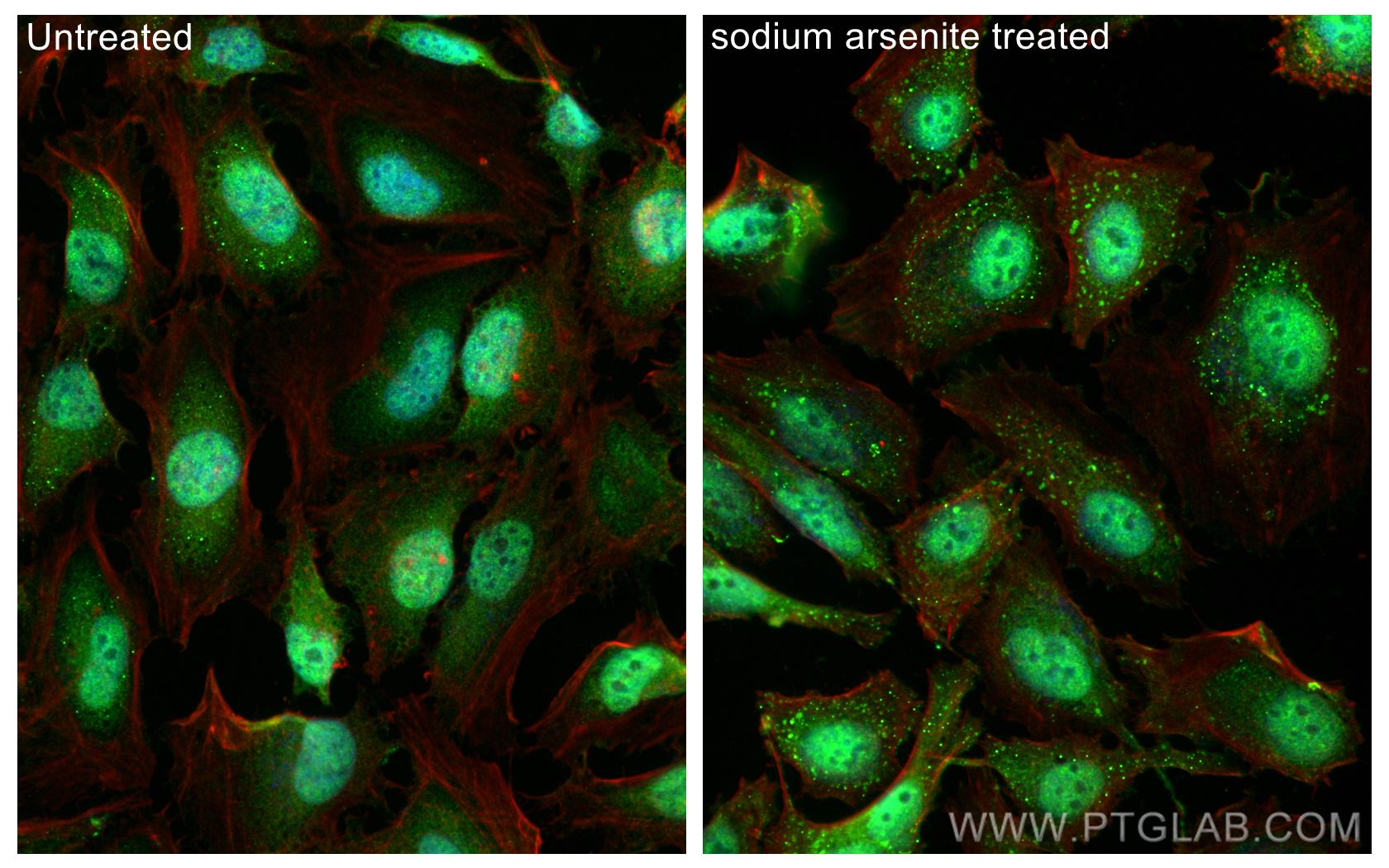 IF Staining of HeLa using 14523-1-AP (same clone as 14523-1-PBS)