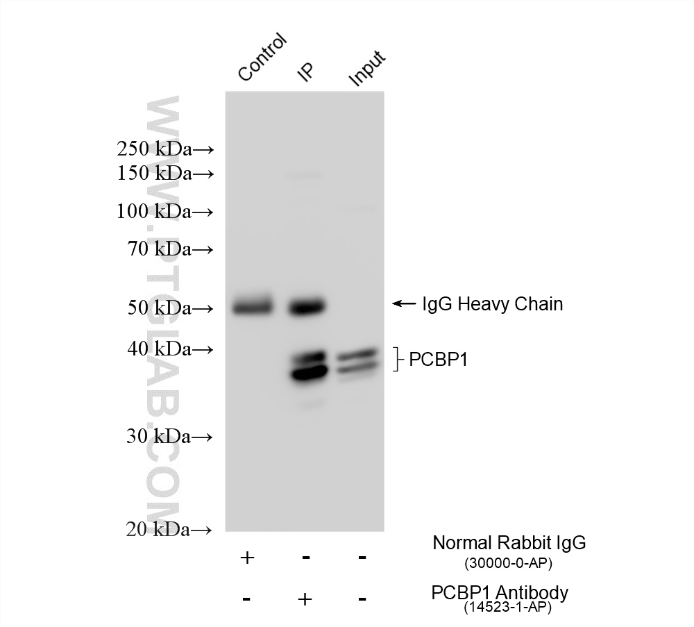 IP experiment of K-562 using 14523-1-AP IP experiment of K-562 using 14523-1-AP