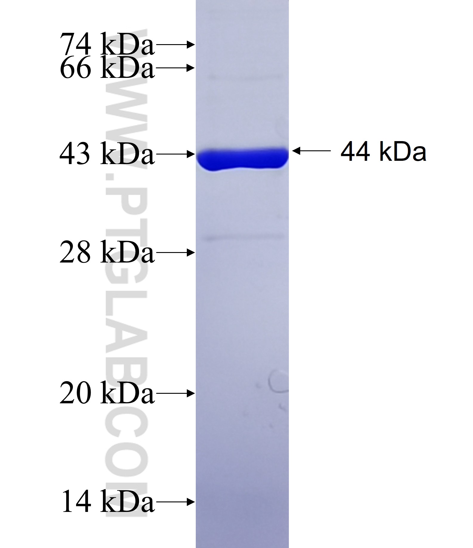 hspX (acr) fusion protein Ag40759 SDS-PAGE hspX (acr) fusion protein Ag40759 SDS-PAGE