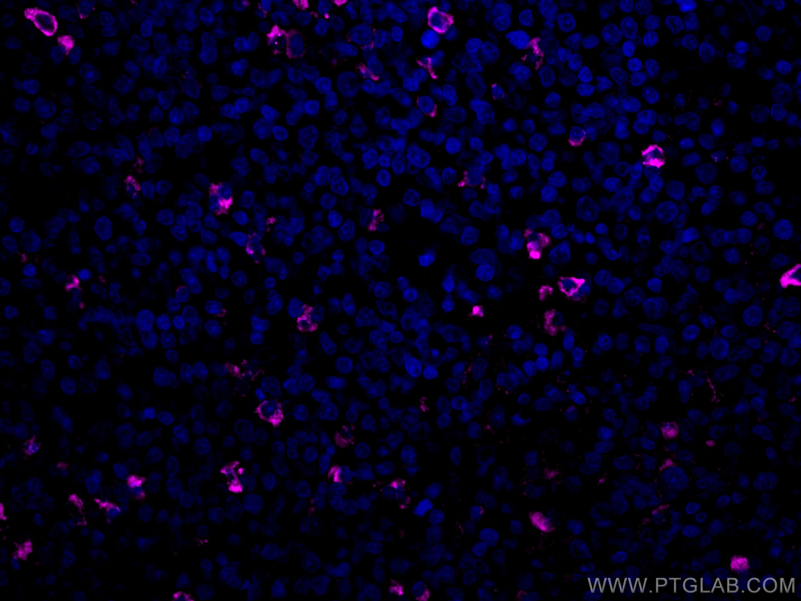 IF Staining of human tonsillitis using CL647-66484