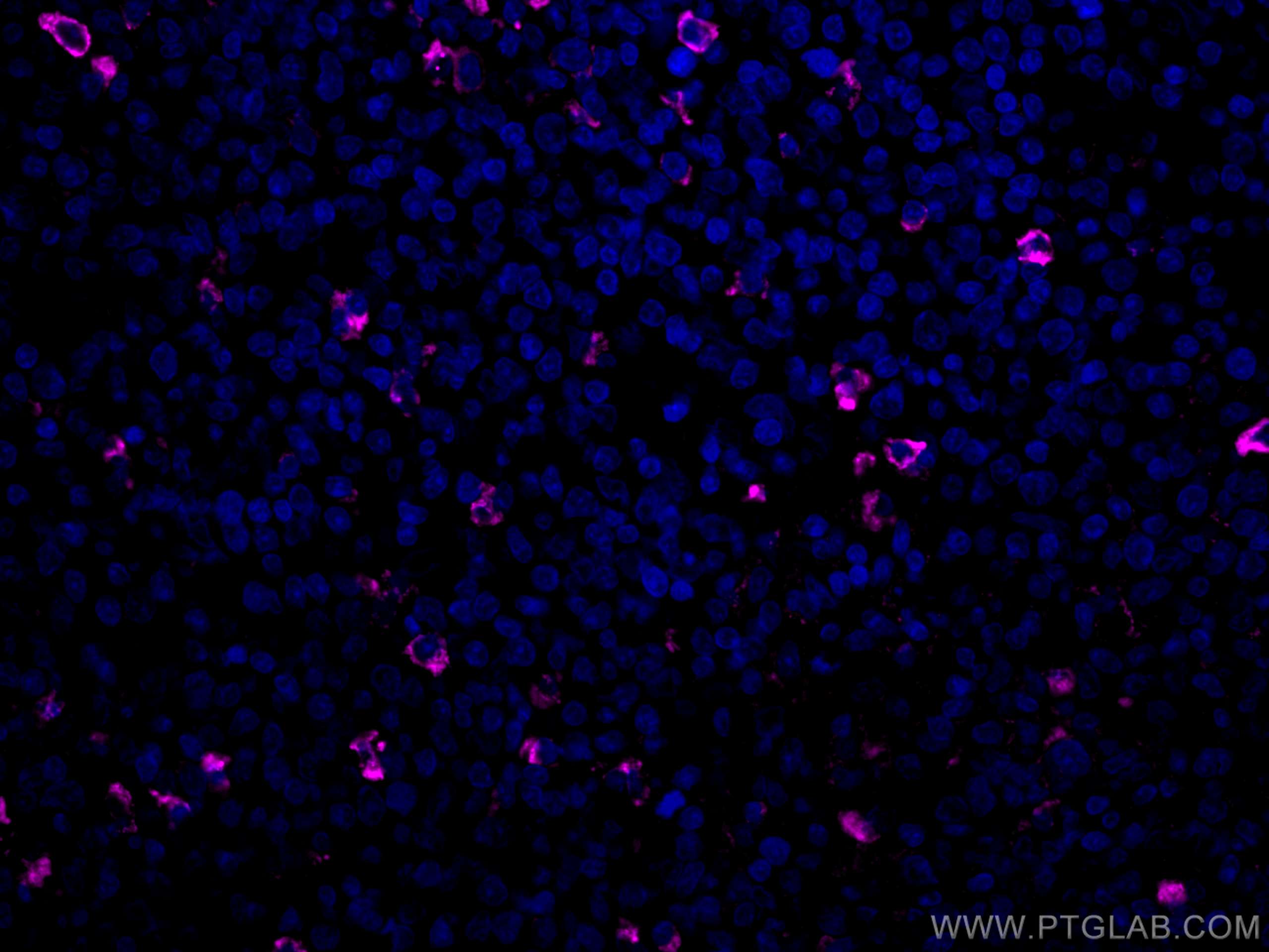 IF Staining of human tonsillitis using CL647-66484